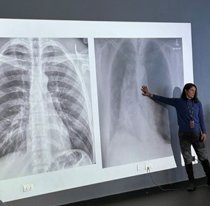 Lindsey Martin, DNP, RN teaching participants in the Trauma Nursing Fundamentals course at University of Global Health Equity in Butaro, Rwanda, March 2025